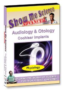 Show Me Science: Cochlear Implants Video