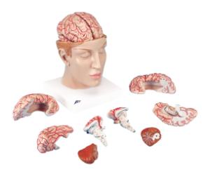3B Scientific® Brain In Head