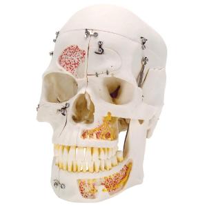 Deluxe Dental Demonstration Skull