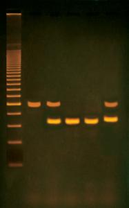 PCR Based Alu-Human DNA Typing Kit