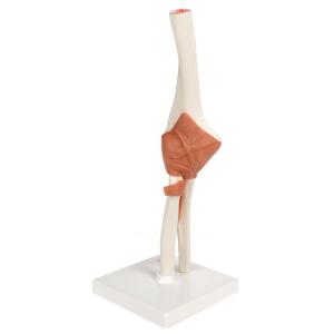 Functional Elbow Joint