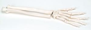 3B Scientific®  Hand And Lower Arm Skeleton