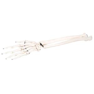 3B Scientific®  Wire Mounted Hand Skeleton With Partial Radius And Ulna