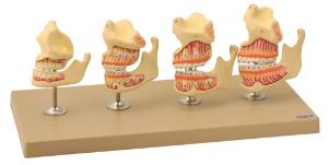 Eisco® Dentition Development Set