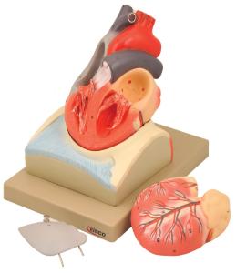 Eisco® Heart on Diaphragm Model