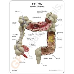 GPI Anatomicals® Colon Model