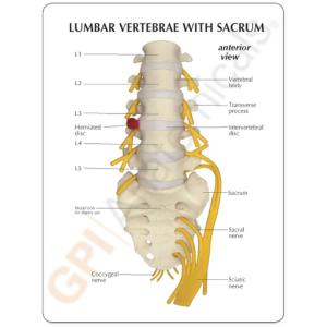 GPI Anatomicals® Flexible Lumbar Vertebrae