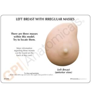 GPI Anatomicals® Left Breast With Irregular Masses