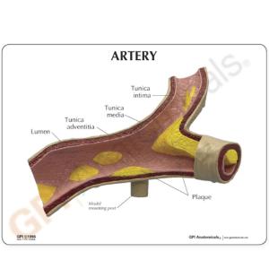 GPI Anatomicals® Introductory Artery Model