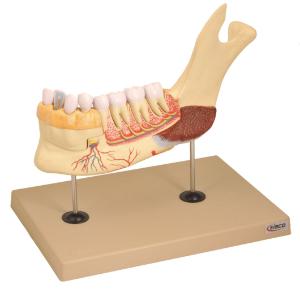 Eisco® Enlarged Human Lower Jaw with Teeth, 3 Parts
