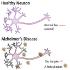 Neuron comparison