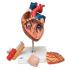 3B Scientific® Heart With Esophagus And Trachea