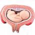 Fifth Month Foetus Transverse