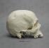 BoneClones® Human Male Cranium with Hammer Blows