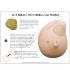 GPI Anatomicals® Left Breast With Irregular Masses